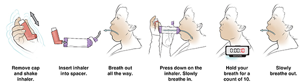 Six steps in using metered-dose inhaler with a spacer.